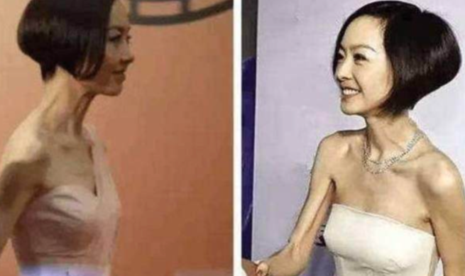 瘦到病态，动脸成瘾，切胃、剪肠齐上阵，内娱的畸形审美真可怕