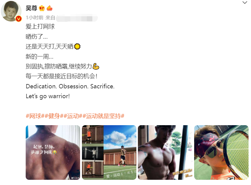 男星吴尊打球晒伤好严重！背部起三大片水泡，脖子上脱皮痕迹明显