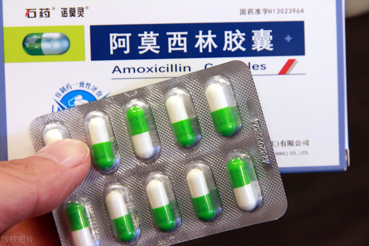 阿莫西林是消炎药吗治妇科炎症吗「阿莫西林是消炎药吗一次吃多少」-