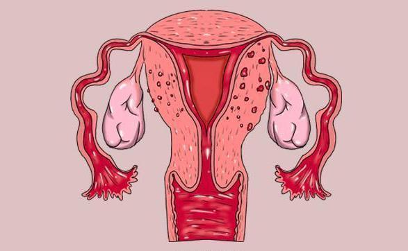 月经老是提前来，究竟是哪有问题？女性朋友进来了解