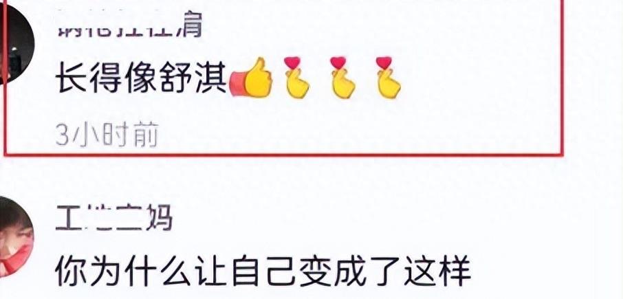 曾是超女冠军,却因整容失败像“怪物”,全身只剩下眼珠是自己的