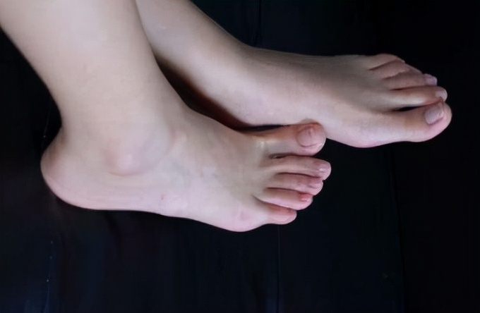 女人壽命長不長，看腳就能知道？ 看看你的腳有沒有這四個特徵？