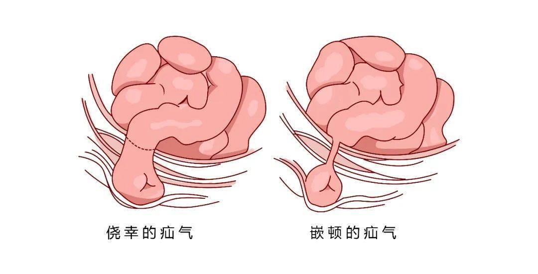 人类平衡能力明明这么差,为什么反而把尾巴退化掉了?