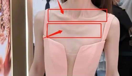 金晨暴瘦30斤吓坏网友； 身体撑不起西服； 网友惊呼：这是山寨的？