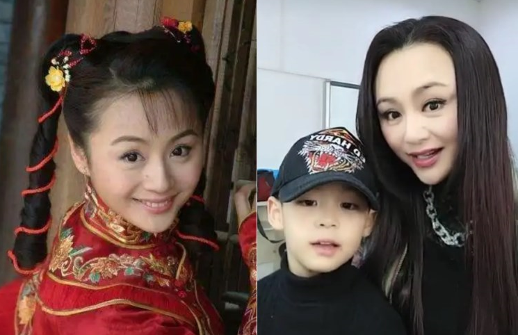 脸部肿成“馒头”，笑起来秒变“僵尸”，这些明星的脸到底咋了？