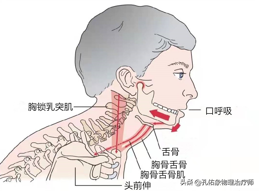 治疗颈椎方法(颈椎病如何治？这几个方法很管用，锻炼完特别轻松)