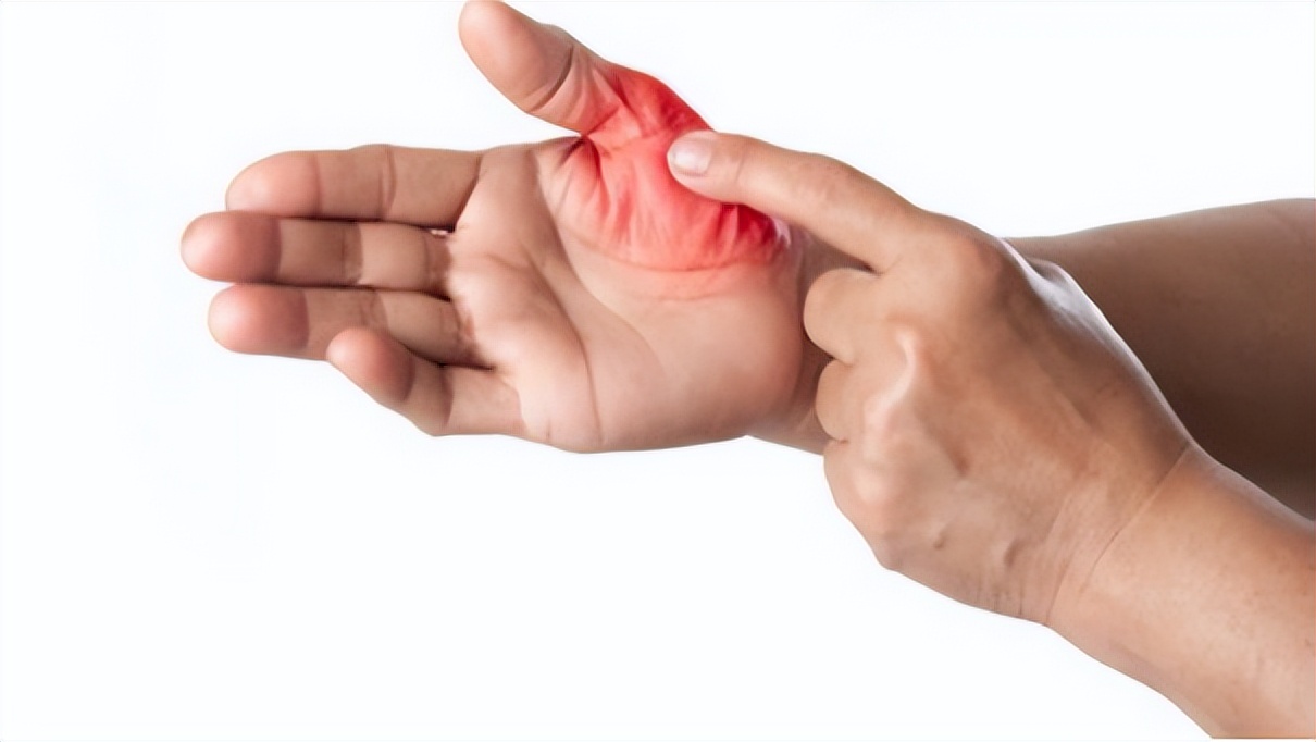 手肿是什么原因 女人手肿是什么病的前兆 - 天云网