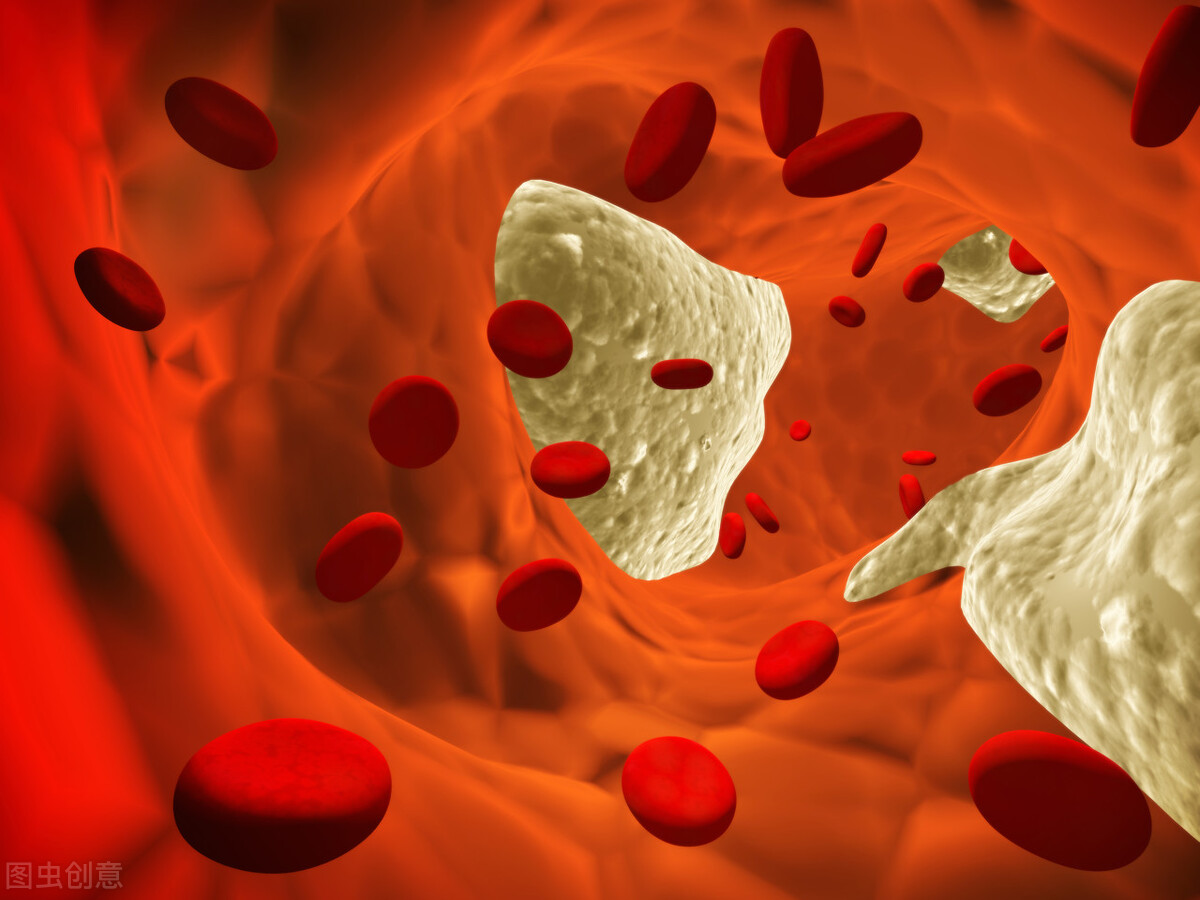 脑血栓怎么引起的(脑血栓形成是怎么回事)