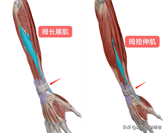 经常手腕疼痛、活动受限，是狭窄性腱鞘炎吗？该怎么办？