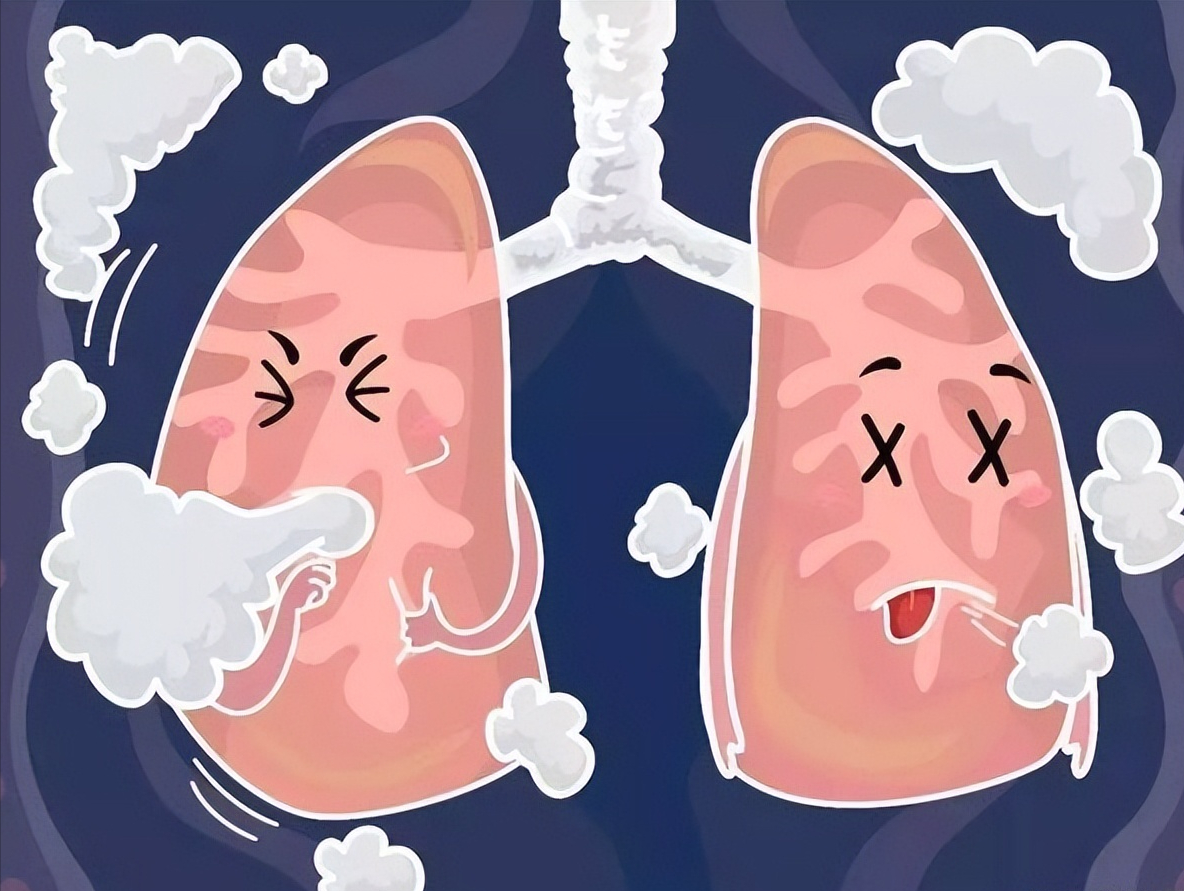 俗话说“黄痰轻，黑痰重，白痰要了命”，是真的吗？揭开痰的秘密