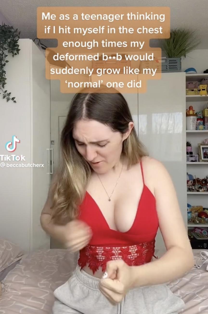 女人a乳房图片大全图片搜索(英国妹子胸部“左A右D”，被嘲笑了10年，最后发现患有罕见病……)