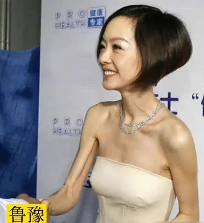 瘦成“排骨”真好看吗？没有修图下的她们，瘦到令人心疼