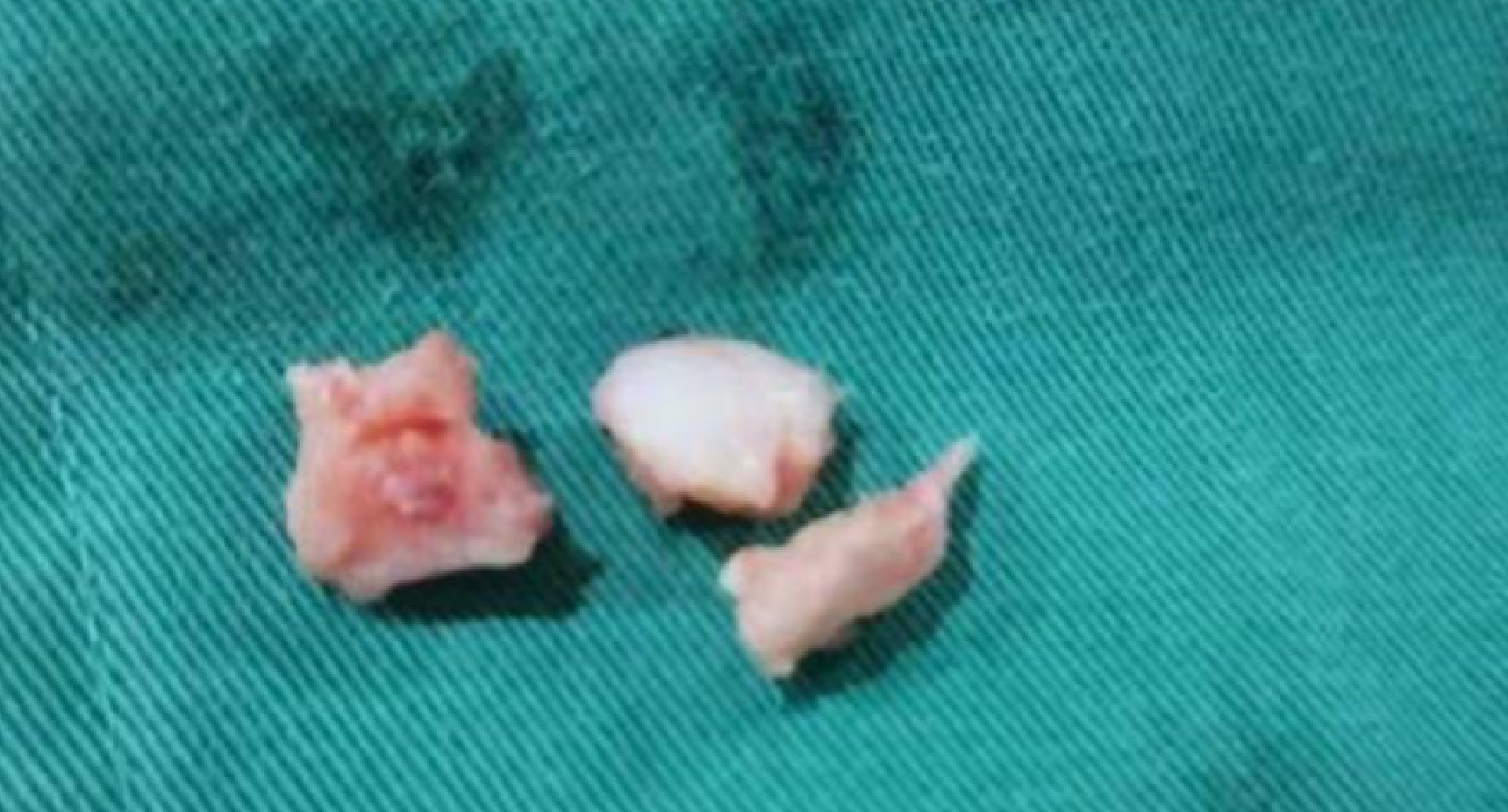 四川一“楼长”学姐查零食，13岁女生被罚150个下蹲，致终身残疾