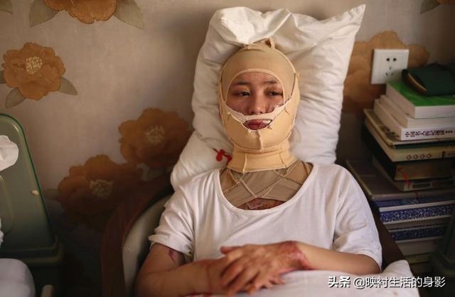 16岁女生在校遭到同学追求，多次表示拒绝后，同学竟将她毁容