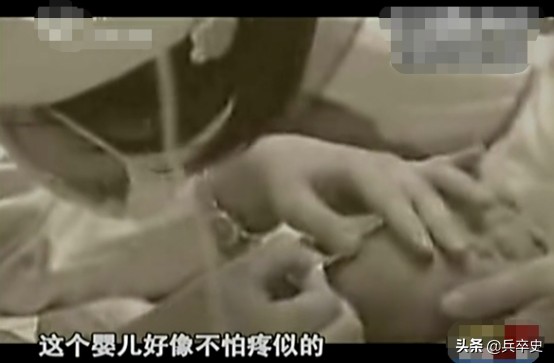 真实故事：山东17岁男孩无痛感汗腺，自我伤害博痛觉，父母泪崩