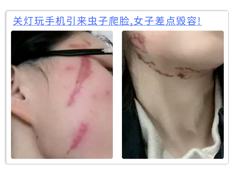 晚上关了灯玩手机，时间长了会怎么样。三个结果可能受不了