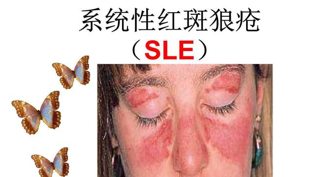 比较难治愈的7种疾病：艾滋病、渐冻人症上榜，你知道哪几个？