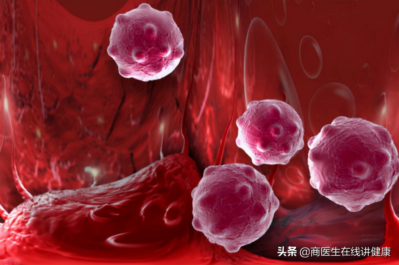 患糖尿病之后，会不会影响性功能？听医生怎么说