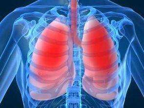 肺气肿可以活几年（肺气肿最多能活几年）