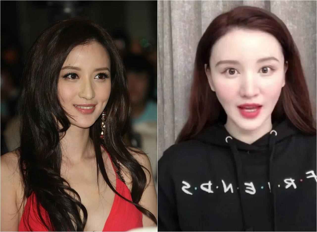 脸部肿成“馒头”，笑起来秒变“僵尸”，这些明星的脸到底咋了？