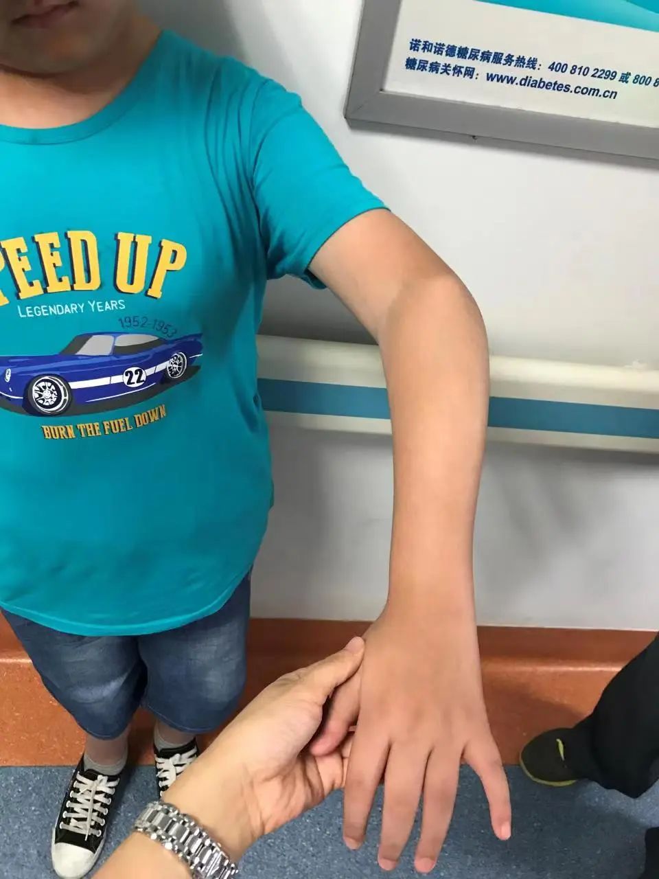 仁医医术| 江西省人民医院帮助“瓷娃娃”活出明亮人生