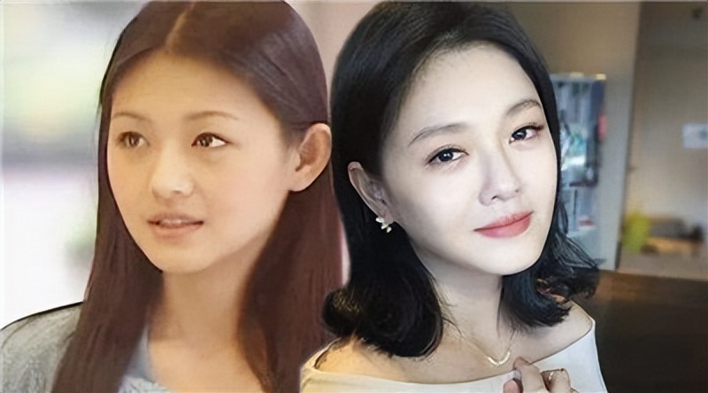 大s美白针效果如何 大s美白针真的有效吗-佳迪双