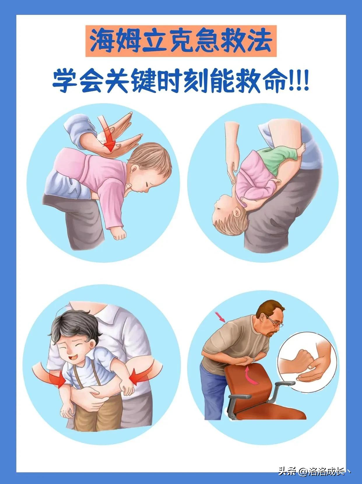 宝宝被食物卡住,这种急救法作为父母你学会了吗?