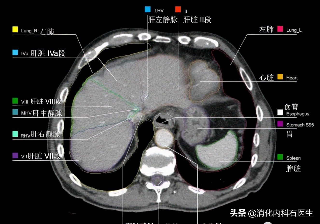 男子腹痛难忍病因难寻，这时肚子上露出一条红线，医生：快会诊