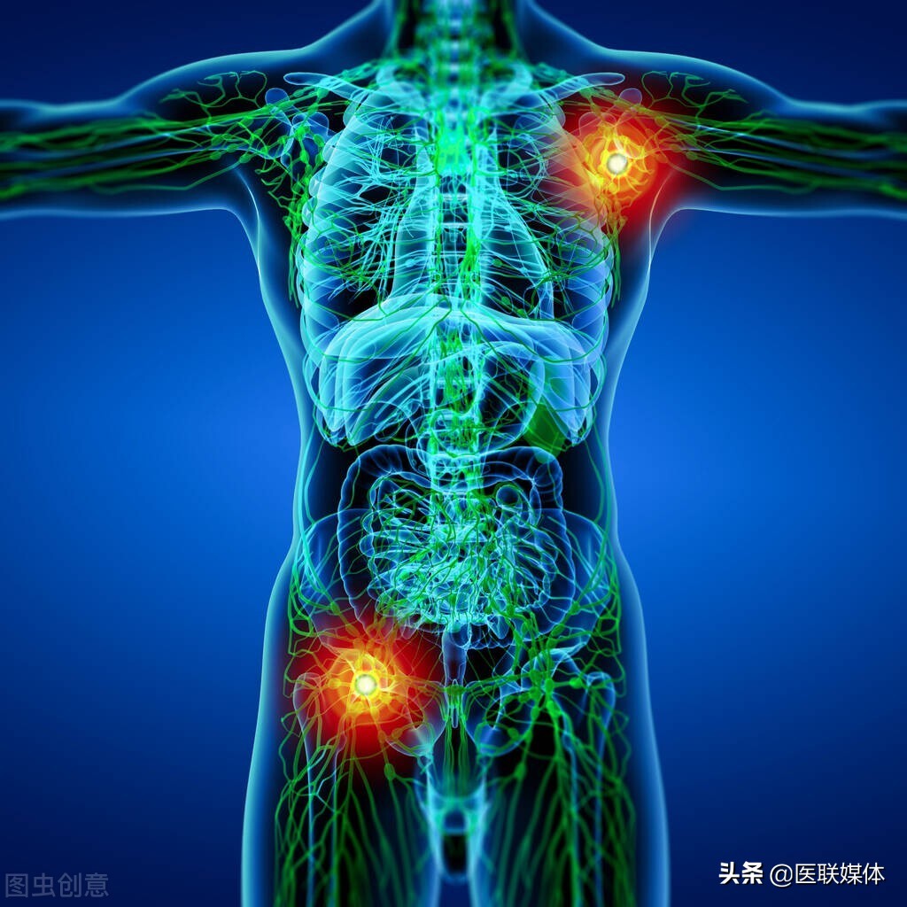 若患上这4种疾病,可能与"淋巴"有关系,别大意了