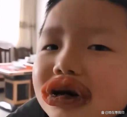 萌娃因“贪吃辣条”嘴巴肿成了香肠，孩子想哭，网友：柿饼？