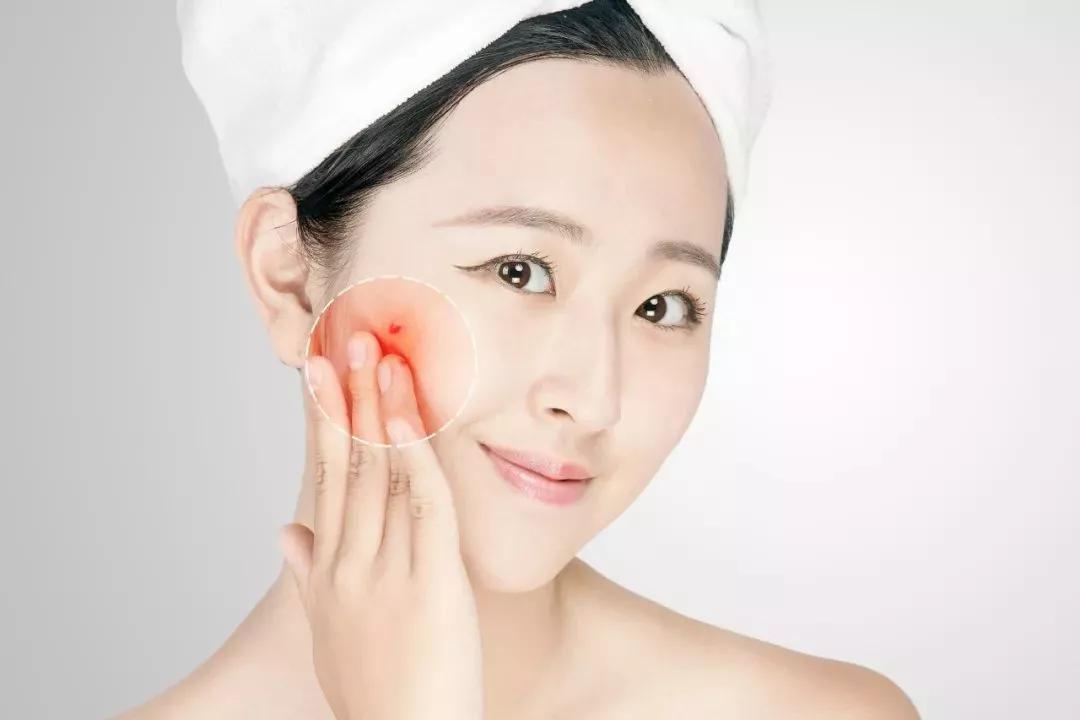 小气泡清洁美肤，真的有神奇的护肤效果？