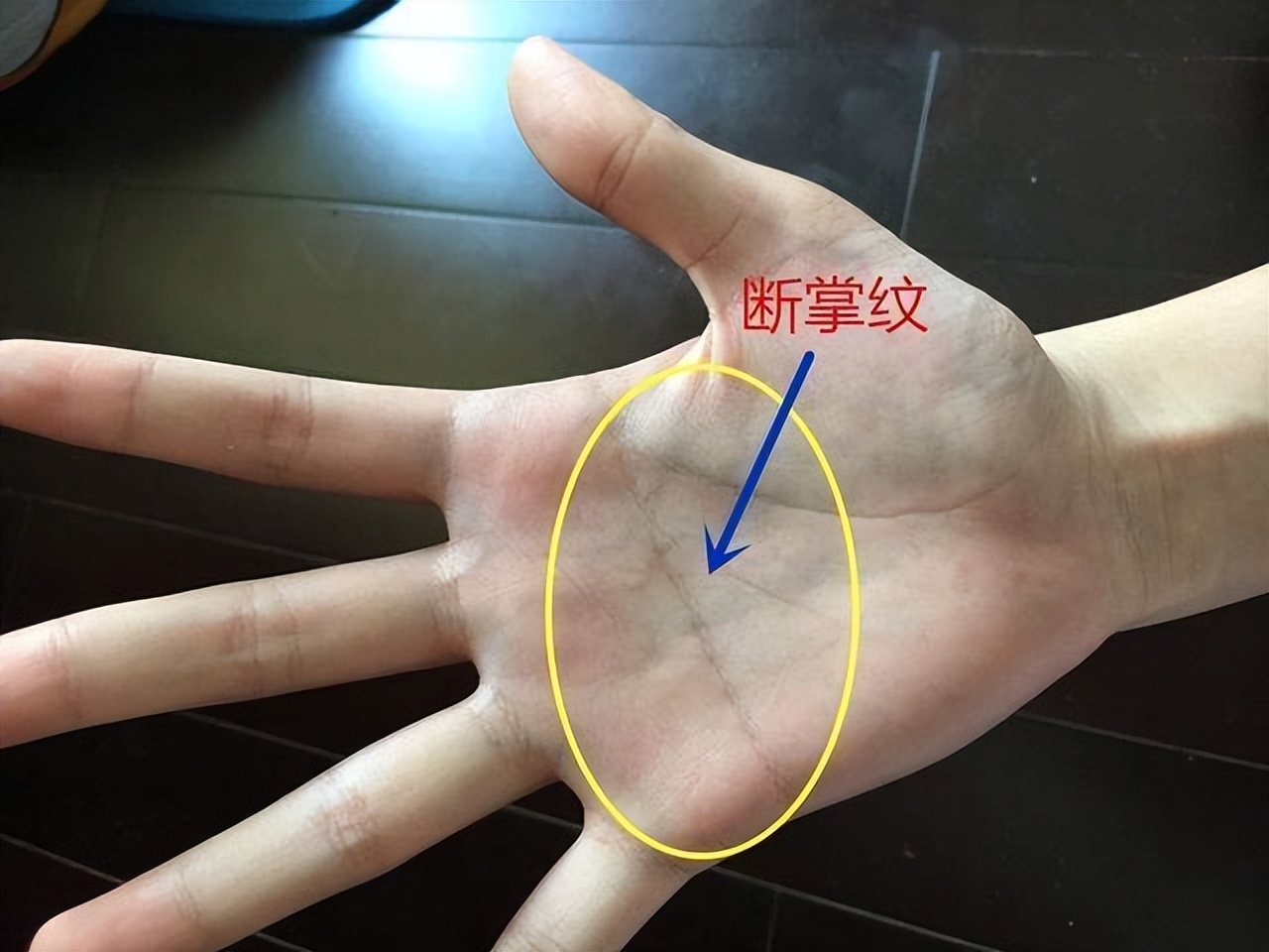 "横纹",表现就是手掌上有一条掌纹贯通左右,属于手部纹路的一种特殊