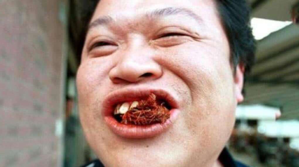 我掉入一个陷阱(6000万国人的噩梦,槟榔危害有多大