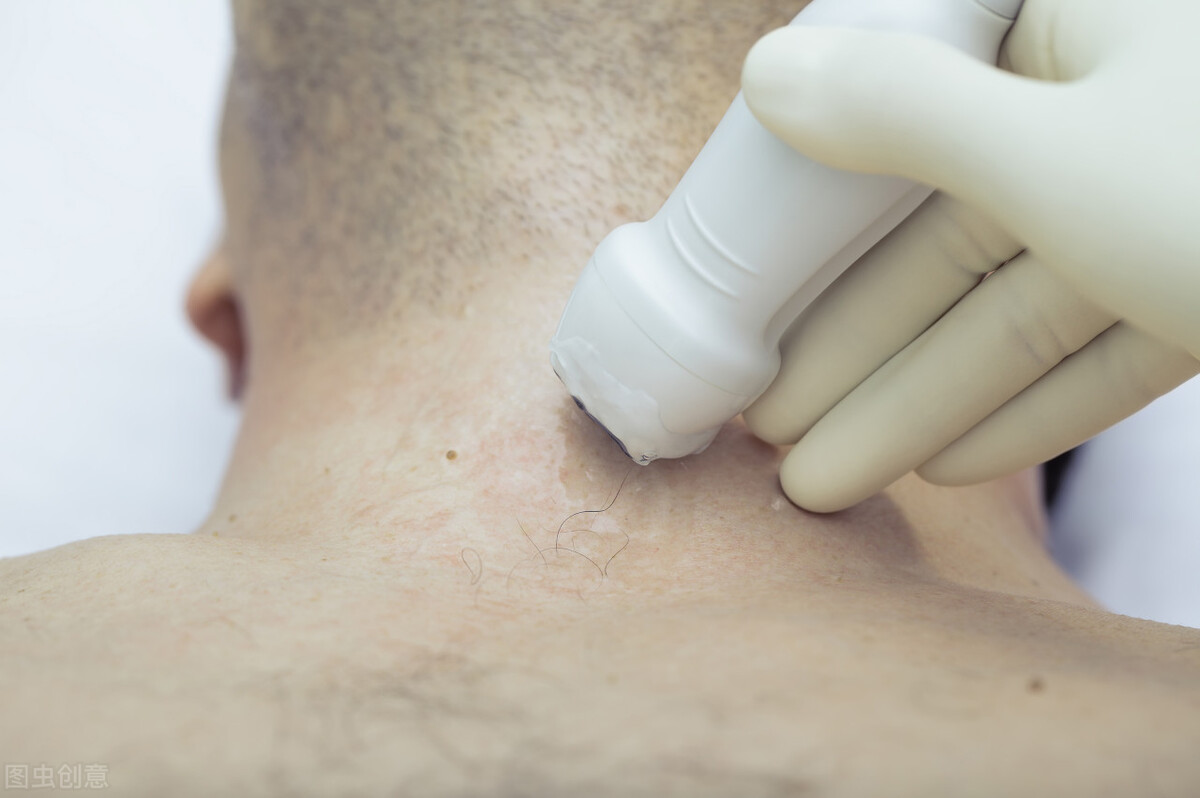 甲状腺结节穿刺到底是怎样一个过程？