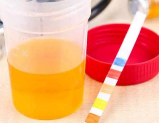肾功能受损有哪些征兆？提醒：除了泡沫尿，还有6种症状