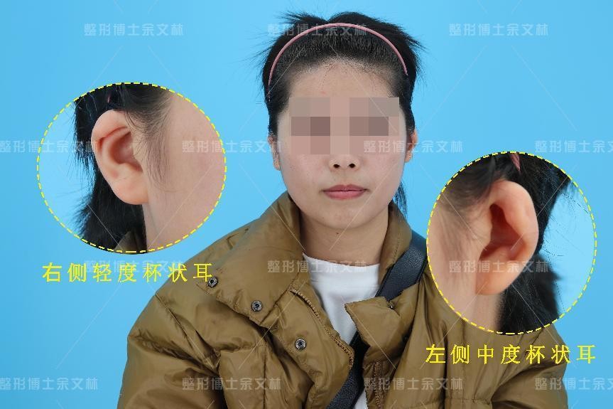 耳朵小的人性格有什么特征吗?_达一风水网