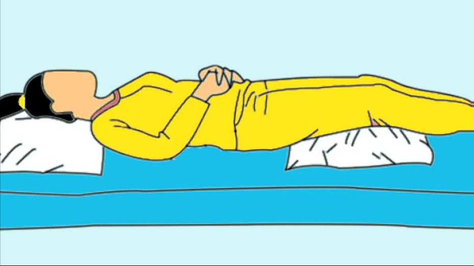 睡觉减肥法的姿势图片(腰椎间盘突出) - 赤虎壹号