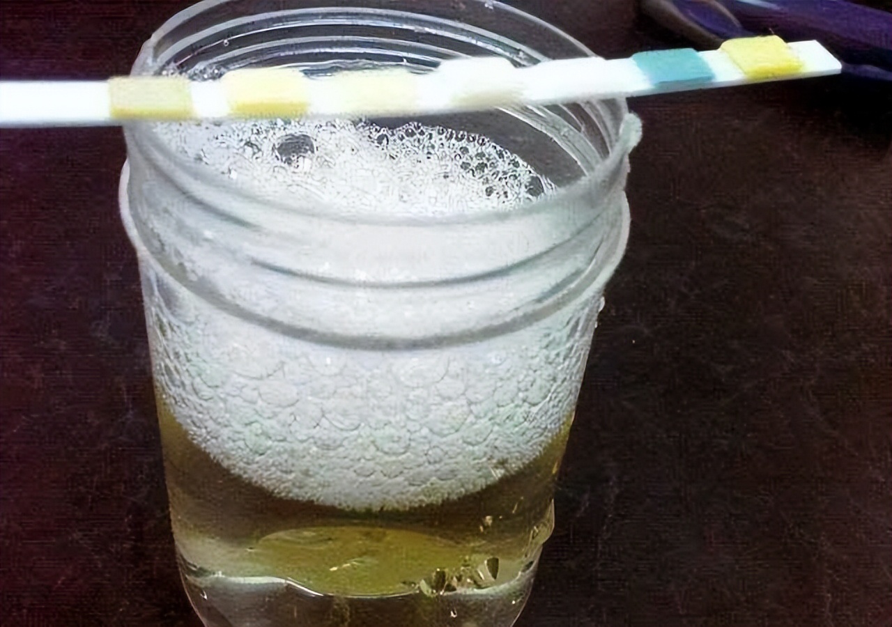 大小便是身体健康的一面镜子，若大小便出现这几种变化，要去检查