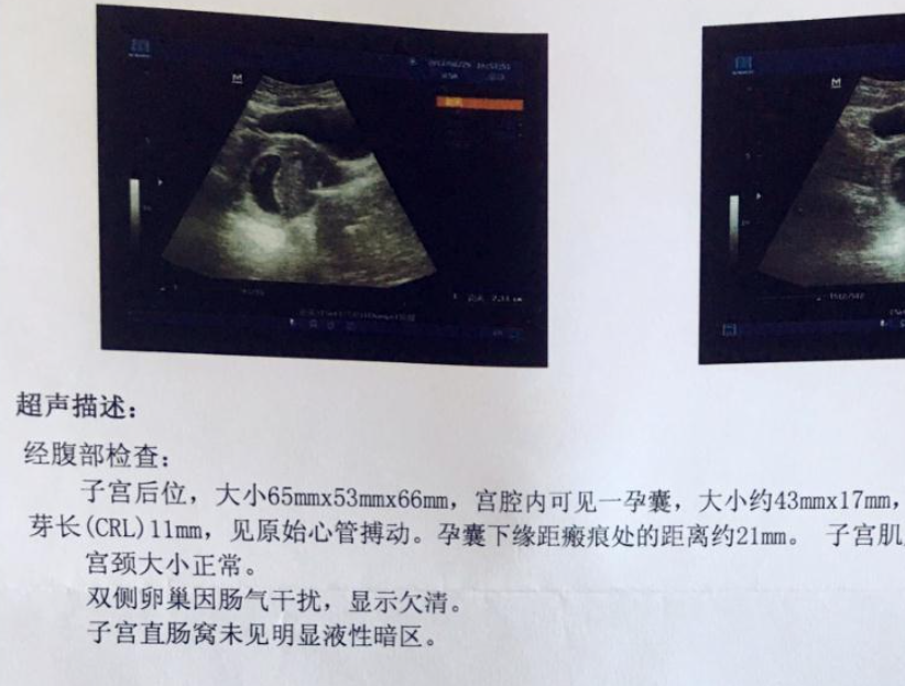 早孕检查只是为了确定怀孕吗？没那么简单，这几件事情更重要