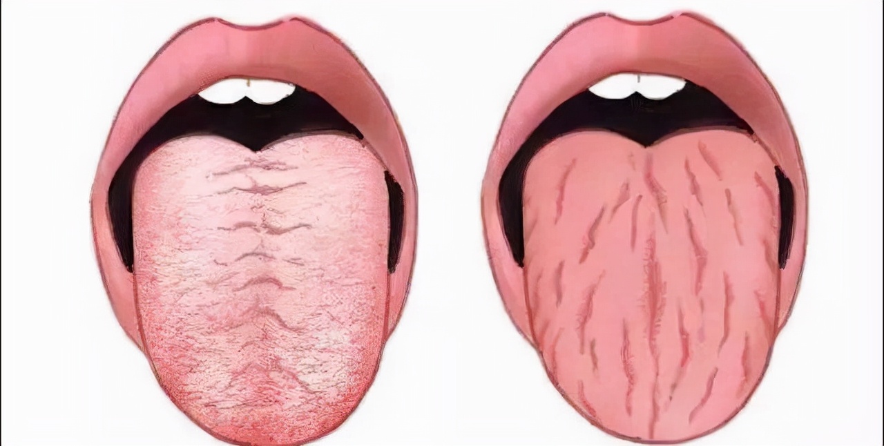 舌诊看的到底是什么？手把手教你看舌诊，学会你就是半个医生了