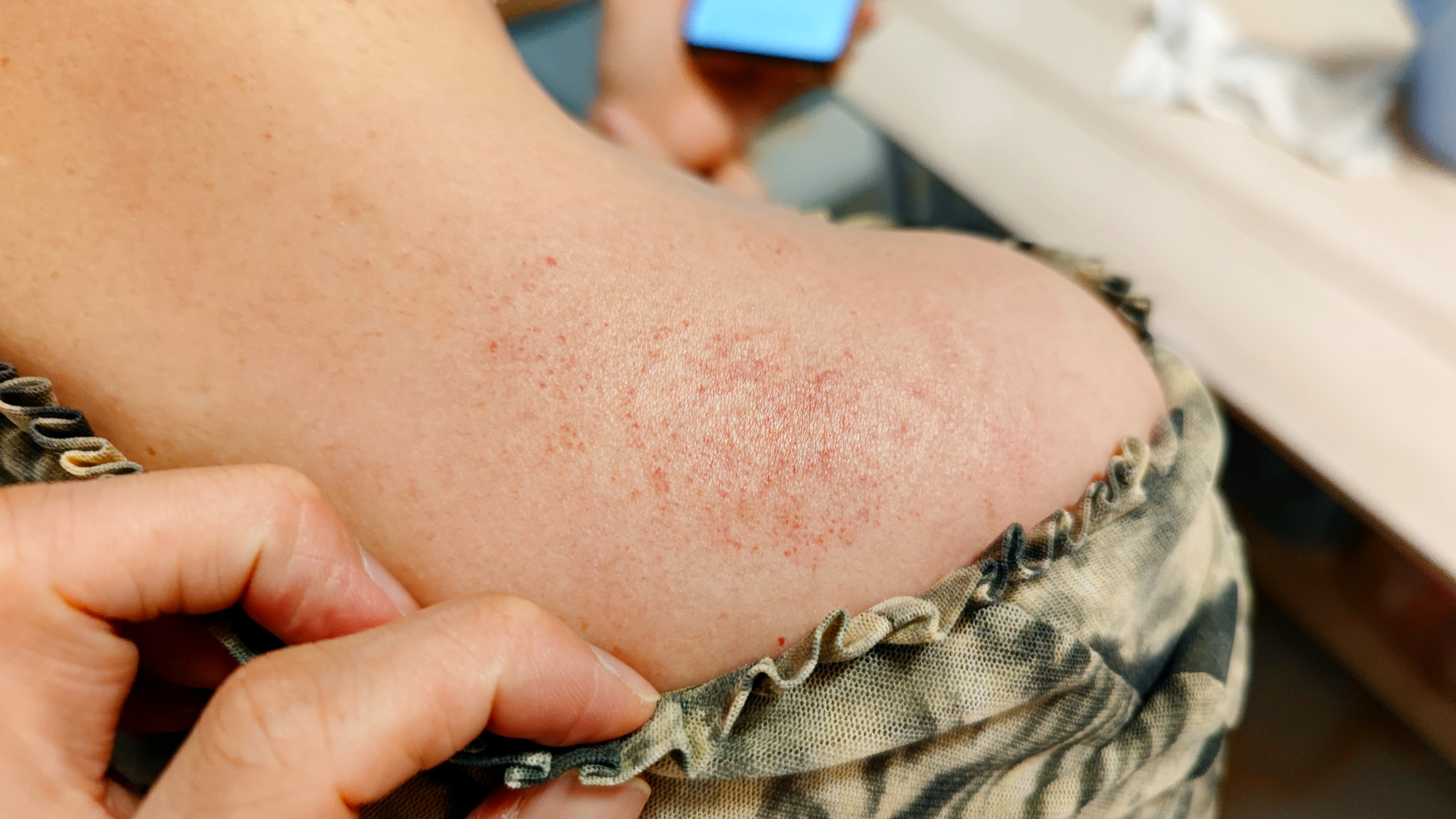 保温杯里泡枸杞，不如走罐健身体！左点走罐按摩器初体验