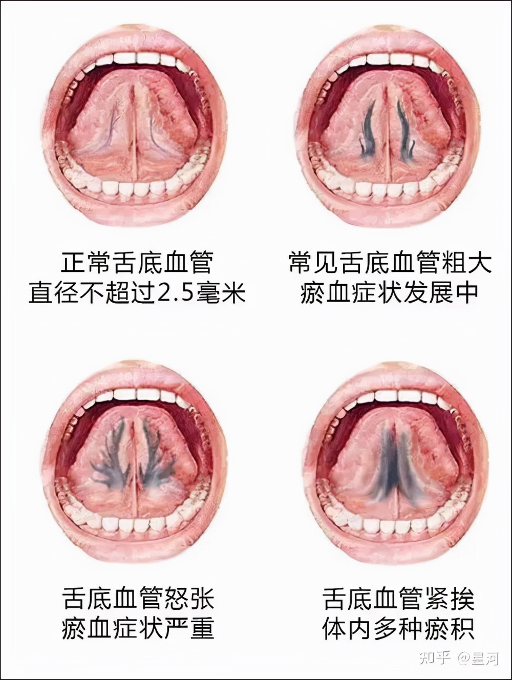 舌诊看的到底是什么？手把手教你看舌诊，学会你就是半个医生了