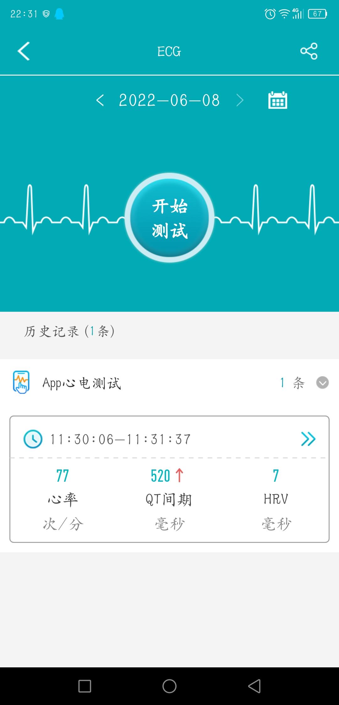 Dido Y1-一款可以智能心电图疾病筛查的智能手环