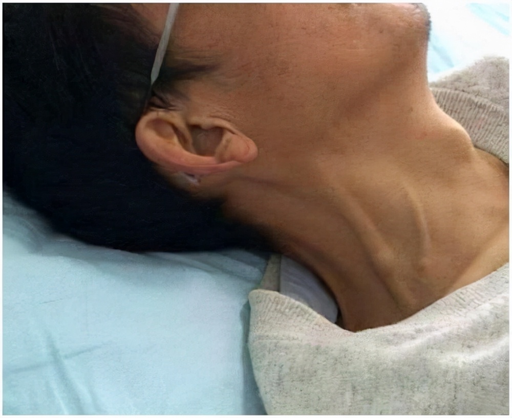 若身体当中这3个部位，出现了“青筋凸起”的情况，就要引起重视