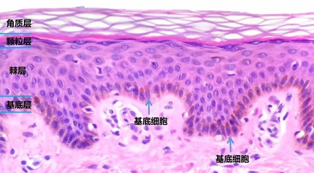 鼻头一粒小疙瘩,几年长成黑色“乒乓球”,一查竟是癌