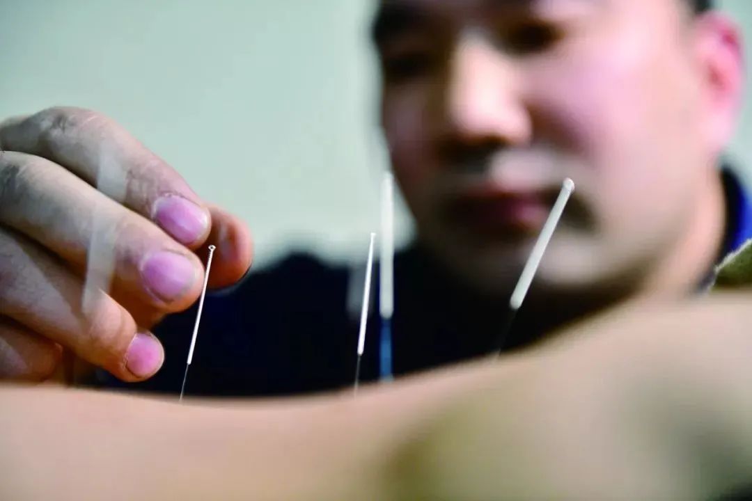 中医专长类申请非物质文化遗产还需细致了解一下