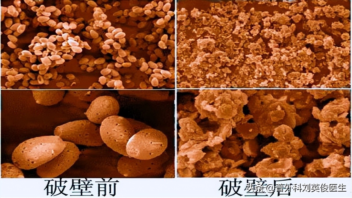 靈芝孢子粉，到底是養生好物還是慢性毒藥？ 癌症患者可以吃嗎？