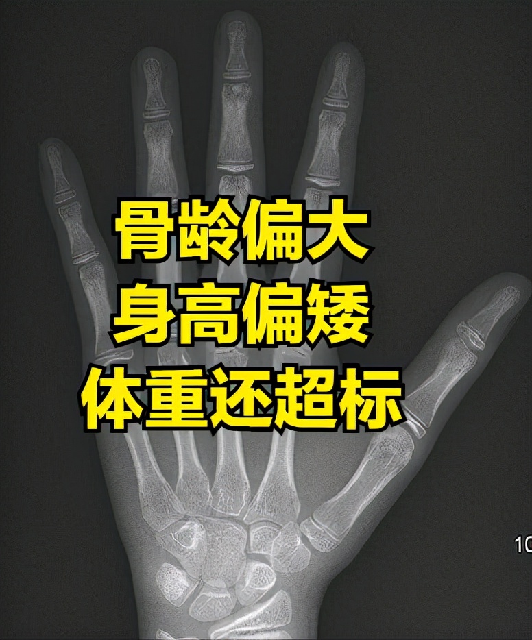 孩子身高偏矮怎么干预？怎么追赶？儿童身高干预的6大方案全解析
