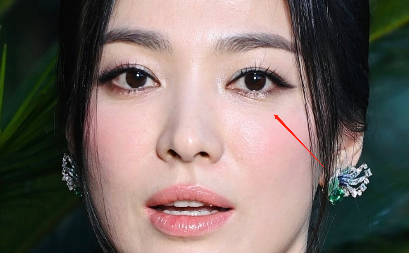 42岁宋慧乔外网生图翻车，法令纹多还地包天，被嘲有点儿凶相