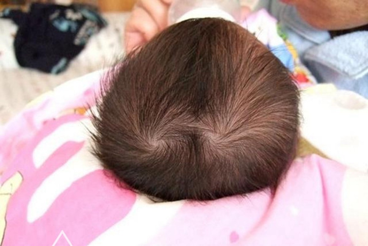 婴儿头骨缝明显的图片（娃头顶的）-幼儿百科-魔术铺